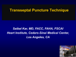 Transseptal Puncture Technique