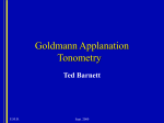 Goldmann Applanation Tonometry