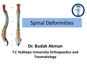 spinal deformity and dej spine 5 sınıf