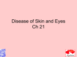 Diseases