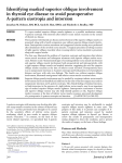 Identifying masked superior oblique involvement in thyroid