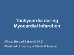 Tachycardia during Myocardial Infarction