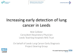 Increasing early detection of lung cancer in Leeds