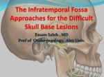 Management of Infratemporal Fossa Lesions