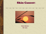 Skin Cancer Powerpoint