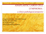 Anaplastic Large Cell Lymphoma:- a clinico