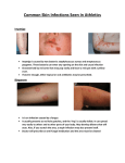 Common Skin Infections Seen in Athletics Impetigo