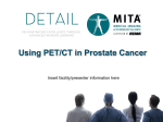 Using PET/CT in Prostate Cancer