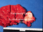 Pancreatic Cancer