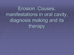 Erosion. Causes, manifestations in oral cavity, diagnosis making