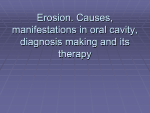 Erosion. Causes, manifestations in oral cavity, diagnosis making