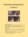 Prosthetic Laryngoplasty (Tie Back) Intra-Op