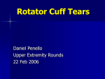 Rotator Cuff Tears -