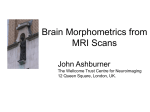 Brain morphometrics from MRI scans data