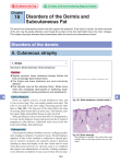 18 Disorders of the Dermis and Subcutaneous Fat