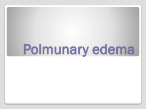 Pulmonary Edema Pulmonary edema is defined as abnormal