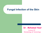 Superficial Fungal Infection