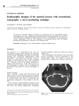 Radiographic imaging of the mastoid process with conventional