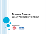 Screening for Bladder Cancer: What You Need to Know