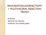 pancreatoduodenectomy + multivisceral resection yes/no