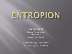 ENTROPION - medicine1.zu.edu.eg