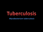 Tuberculosis - faculty development