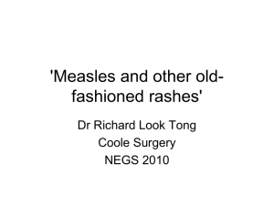 `Measles and other old-fashioned rashes`