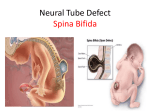 Neural Tube Defect Spina Bifida