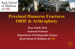 Proximal Humerus Fractures