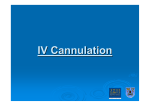 IV cannulation