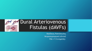 Dural Arteriovenous Fistulas (dAVFs)