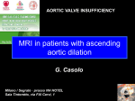 EAE- MRI in patients with ascending aortic dilation
