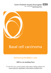 Basal cell carcinoma - University Hospitals Birmingham