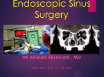 Primary Sinus Surgery