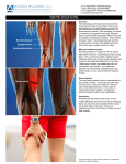 Semitendinosus Biceps femoris Semimembranosus Severe strain