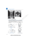 2 Cervical Spine: AP Projection