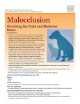 Malocclusion