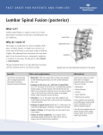 Lumbar Spinal Fusion (posterior)