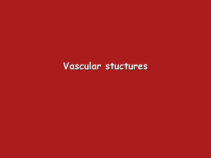 Accessory middle cerebral artery