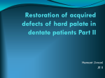 Restoration of Acquired Hard Palate Defects in Dentate Patietns