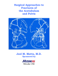 Surgical Approaches to Fractures of the Acetabulum and Pelvis Joel