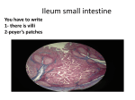Ileum small intestine