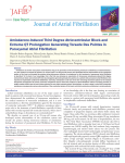 Amiodarone-Induced Third Degree Atrioventricular Block and