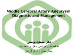 Middle Cerebral Artery Diagnosis and Management