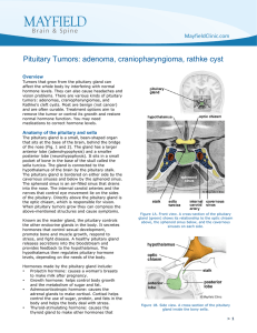 Pituitary Tumors: adenoma, craniopharyngioma