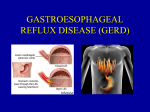 Gastroesophageal Reflux Disease (GERD)