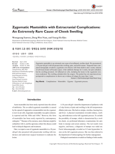 Zygomatic Mastoiditis with Extracranial Complications: An Extremely