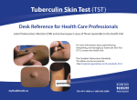 Tuberculin Skin Test (TST)