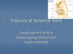 Fracture of temporal bone