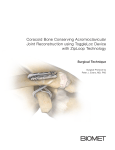 Coracoid Bone Conserving Acromioclavicular Joint